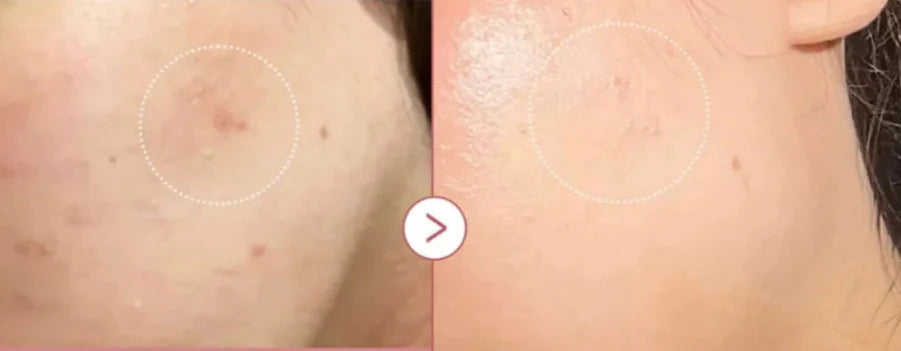 Pulse Renew 20ml micro-spicule renewal serum