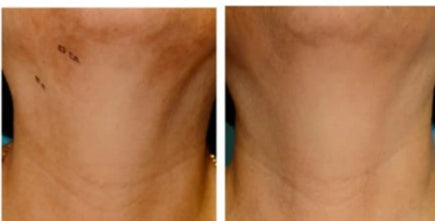 Skin Reset Kit detox and renewal skincare
