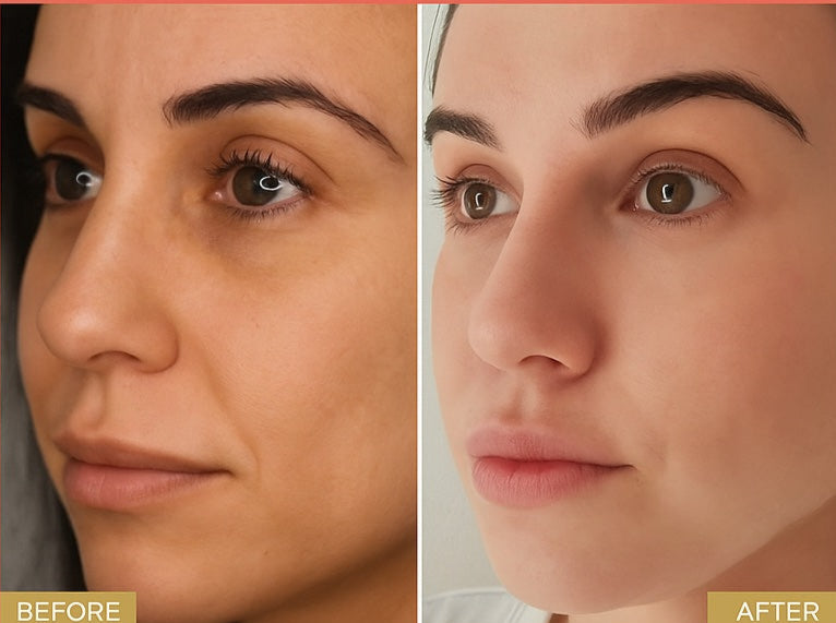 Skin Reset Kit detox and renewal skincare